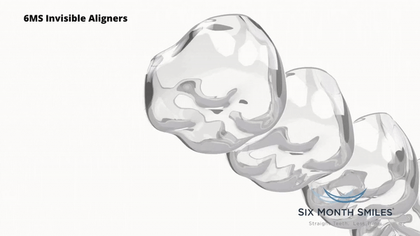 Six Month Smiles, Invisalign, 6MS Invisible Aligners, 6 Month Clear Aligners, Byte, Candid, Smile Direct Club