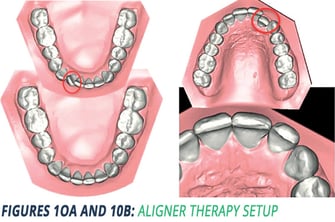 Article Figures 10a-10b