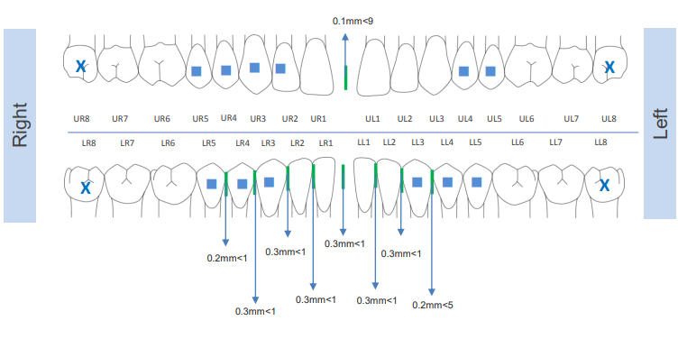 Confidex treatment plan with attachments