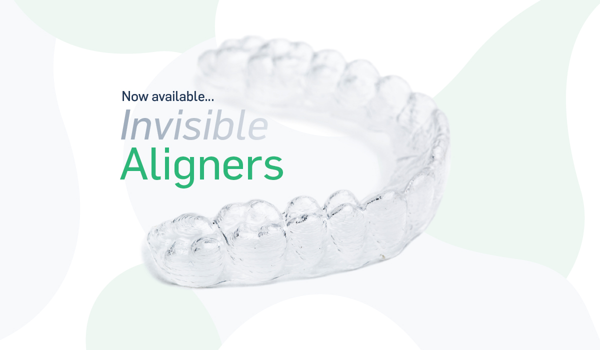 Aligners1