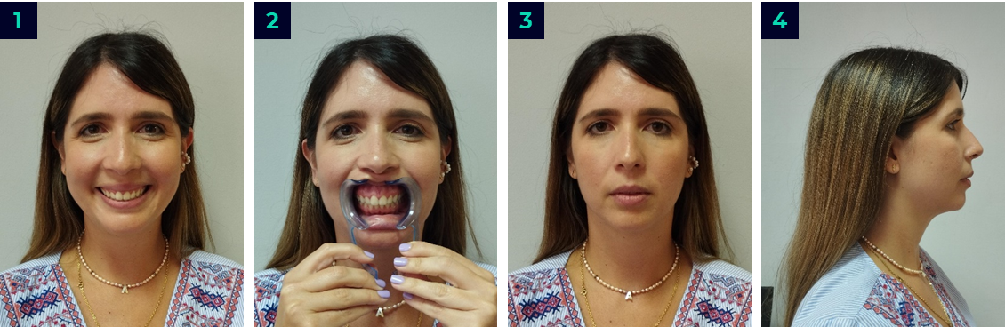 Extraoral Photo Series