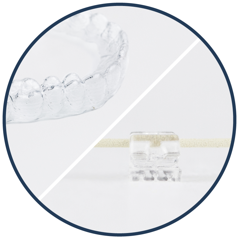 Aligners & Braces