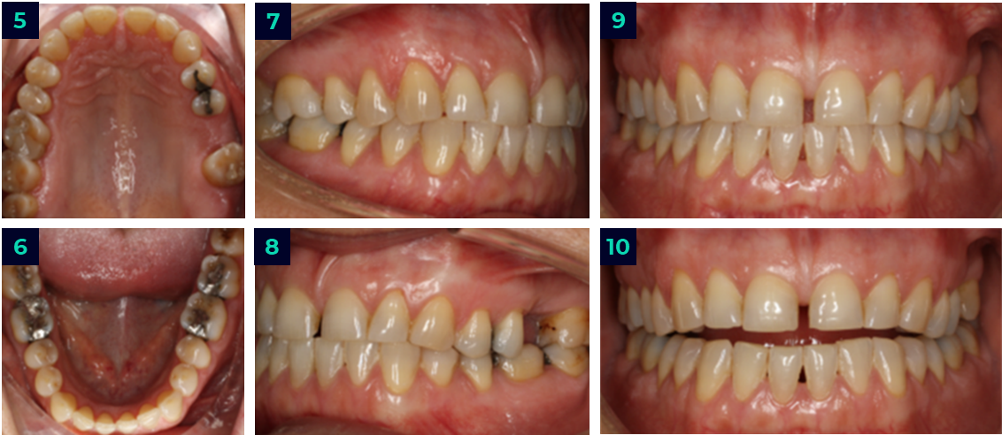 Intraoral Photo Series