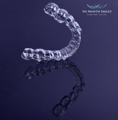 Aligners styled