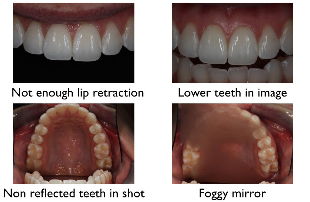 How to Get the Shot 2 Essential Dental Photography Tips