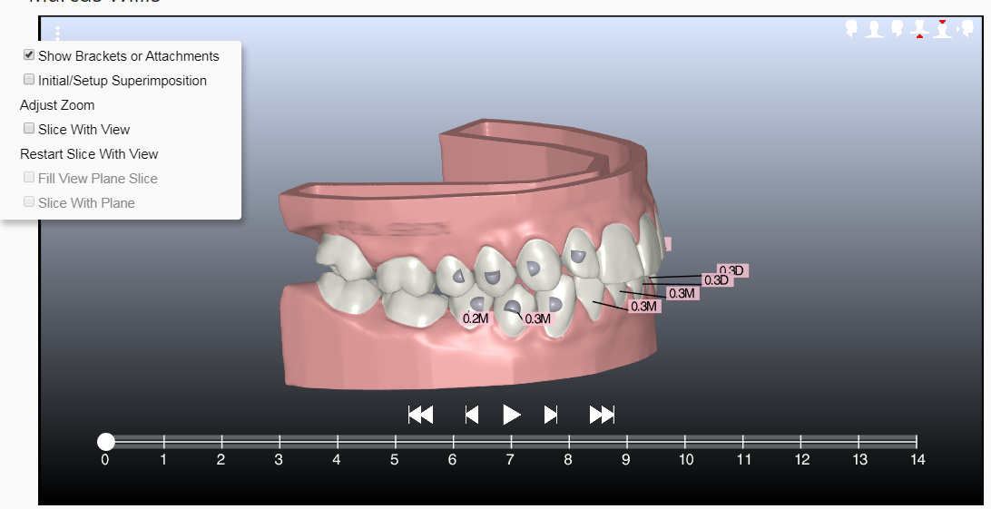 confidex simulation with attachments-1