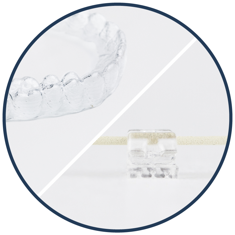 Aligners vs Braces, Which One is Right for My Case?