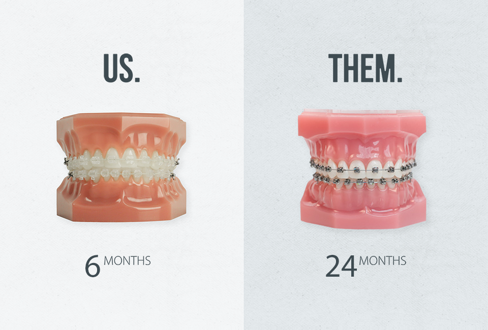 Traditional Orthodontics vs. Short-Term Orthodontics